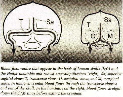 brains.gif (80176 bytes)