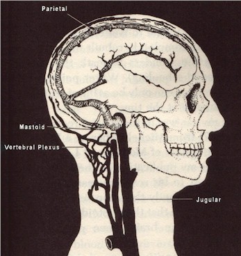 skullscan.jpg (43221 bytes)